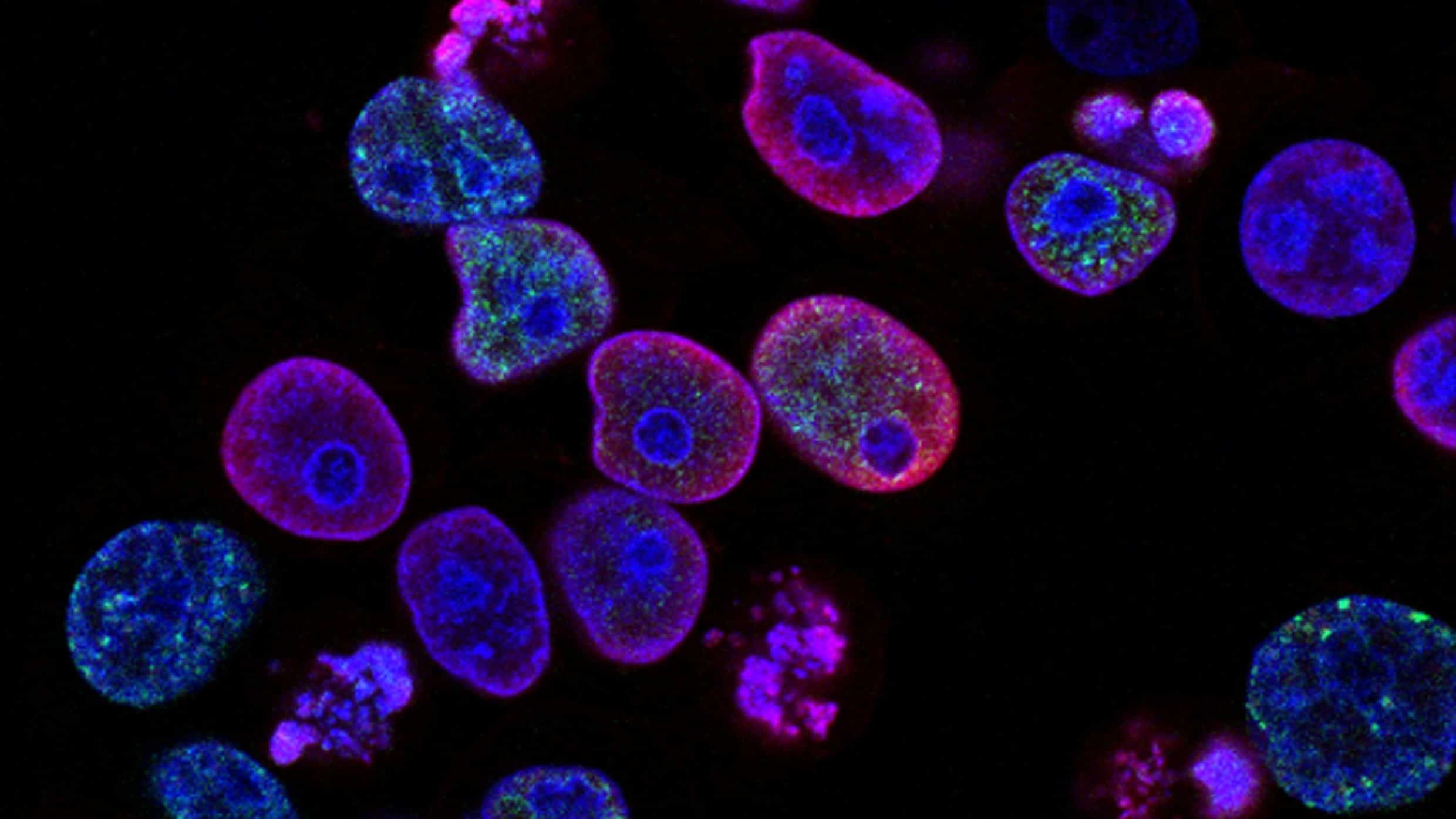 New nanoparticle cancer therapy takes a step closer to clinical trials